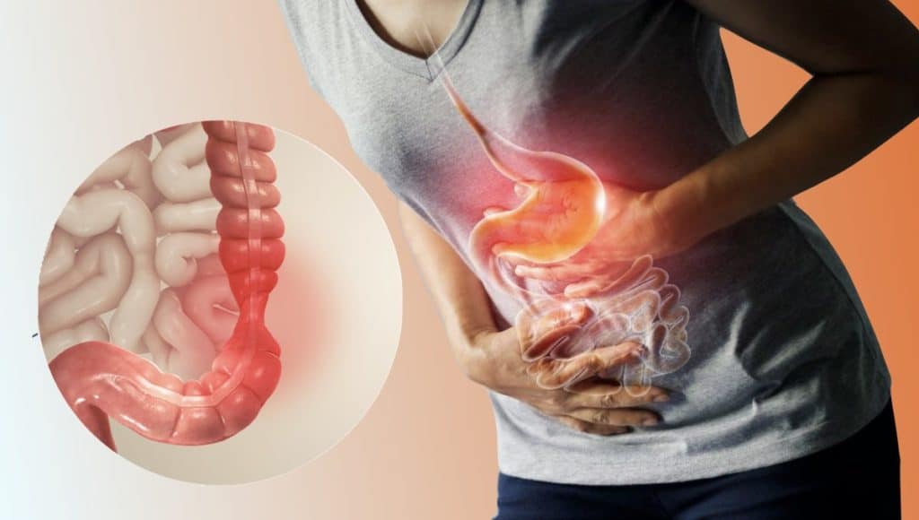 Hội chứng ruột kích thích và sức khỏe, khám phá mối liên kết bất ngờ! 