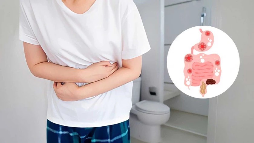 Có thể chữa khỏi hội chứng ruột kích thích tại nhà không? 