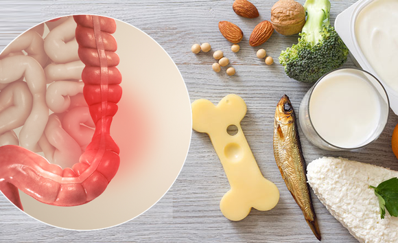 Chế độ ăn Low Fodmap cho người hội chứng ruột kích thích 