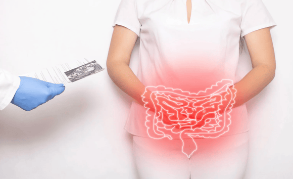 Viêm đại tràng có mấy loại? Phân biệt rõ để điều trị đúng cách 