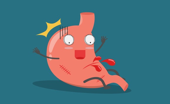Phân biệt xuất huyết tiêu hóa trên và dưới: Cách nhận biết và hướng xử trí