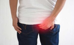 FTT_Viêm đại tràng có dẫn đến trĩ không?