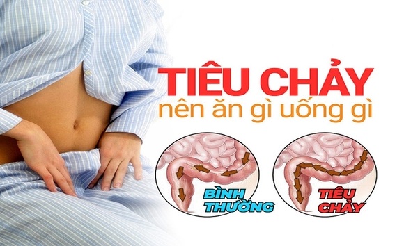 10 thực phẩm người bị tiêu chảy kéo dài nên tránh xa 