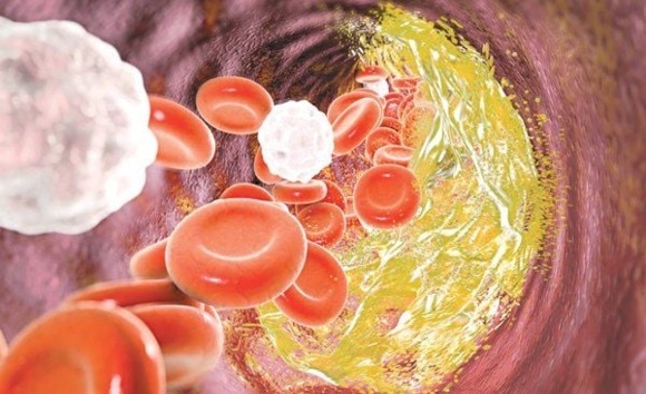 Bỏ qua rối loạn chuyển hóa – bạn có thể trả giá bằng sức khỏe cả đời 
