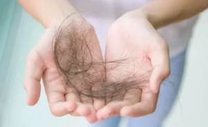 FTT_Nhịn ăn cơm trắng có gây rụng tóc không? Sự thật ít người biết