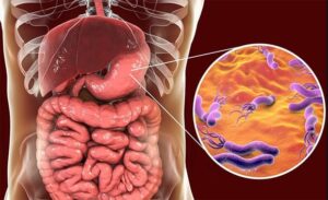 FTT_Nhiễm trùng dạ dày là gì? Nguyên nhân và cơ chế gây bệnh