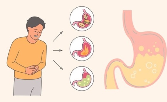 Thiếu enzym tiêu hóa: Dấu hiệu nhận biết và cách khắc phục 