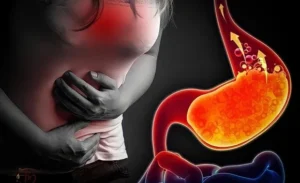 FTT_Tăng acid dịch vị: nguyên nhân, triệu chứng và cách xử lý an toàn