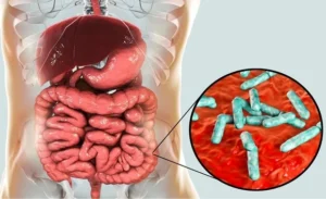 FTT_Thực phẩm sống: “kẻ thù” Âm thầm của đại tràng viêm mãn tính