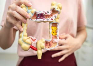 Viêm đại tràng cấp tính là bệnh như nào?