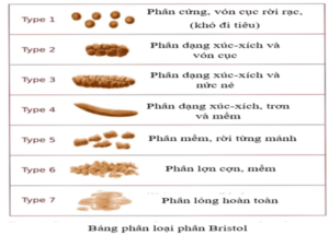 Táo bón chức năng khiến người mắc khó đi người ít hơn 3 lần/ ngày